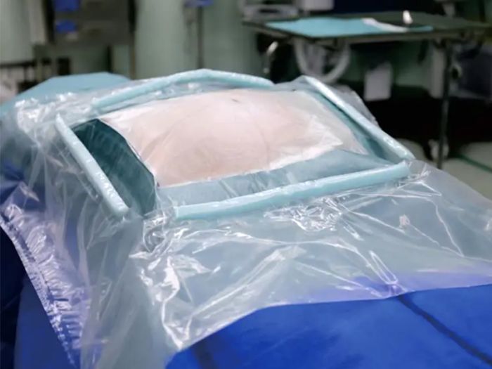 Cesarean section (Integrated) package: Dual guarantees of material and heat sealing technology, safeguarding life