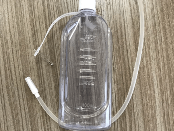 Innovative negative pressure drainage bottle technology reduces the risk of postoperative complications.